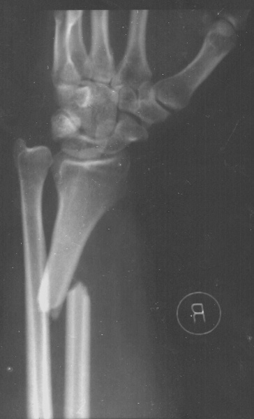 File:Rontgen-tgn17-10-11.jpeg